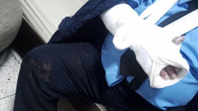 وزارة الصحة تستنكر الهجوم الذي تعرض له مستشفى محمد الخامس بمكناس [صور] 